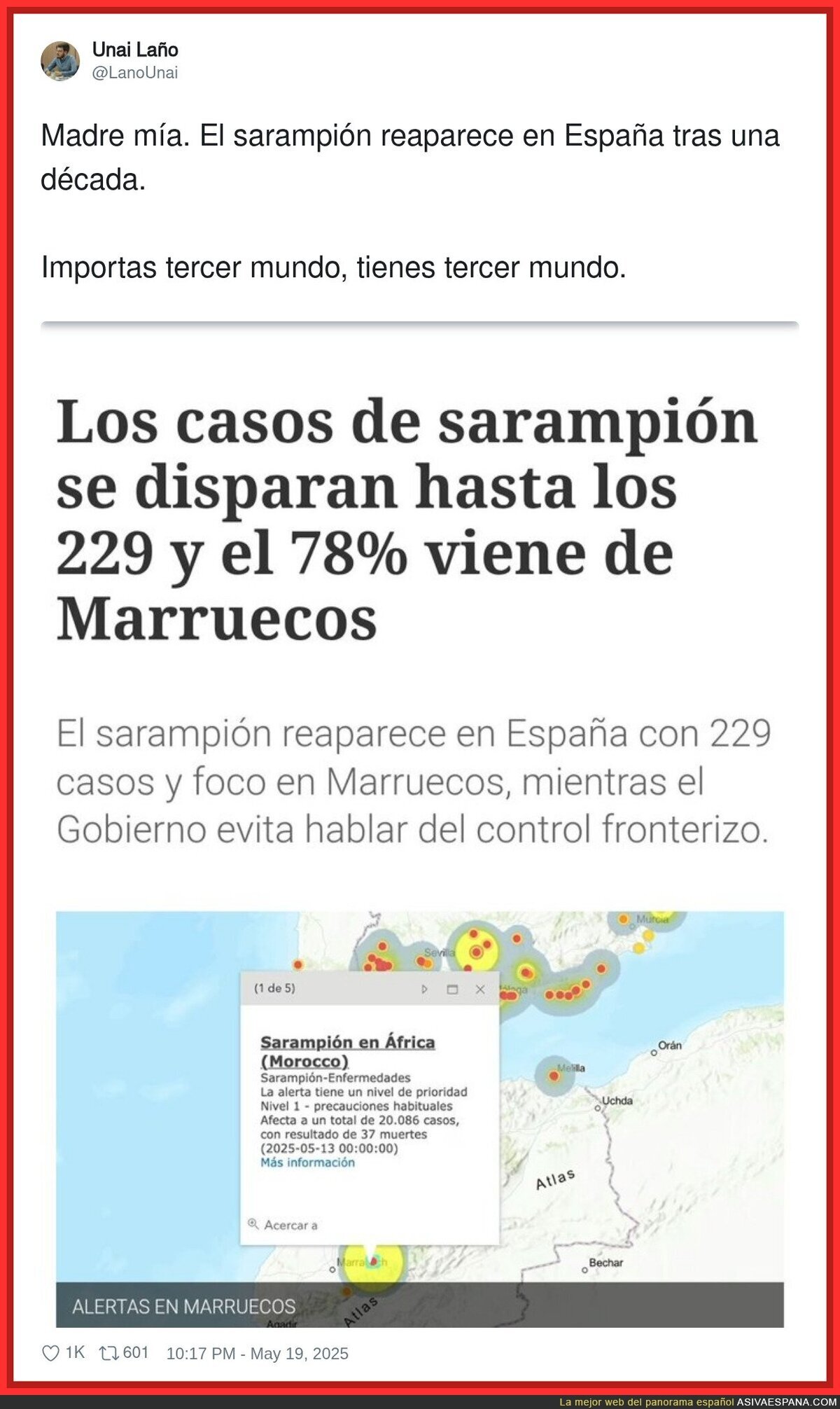 Las casualidades sobre las alertas de sarampión