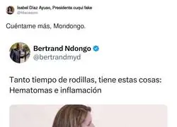 La derecha y su preocupaci&oacute;n por las rodillas