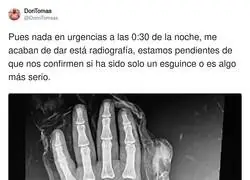 &iquest;Ser&aacute; grave?