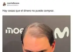 El partido que ha perdido Rafa Nadal