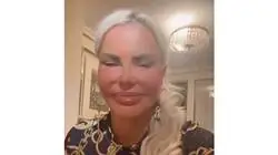 Leticia Sabater se ha vuelto a operar la cara para seguir sirviendo en sus conciertos