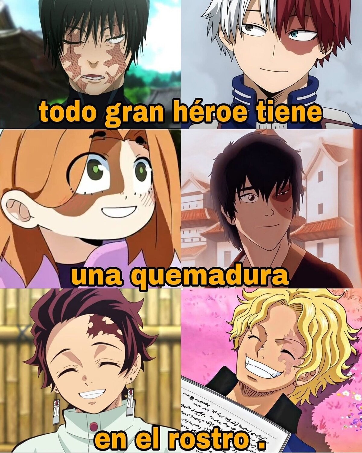 Quemaduras como desarrollo de personaje