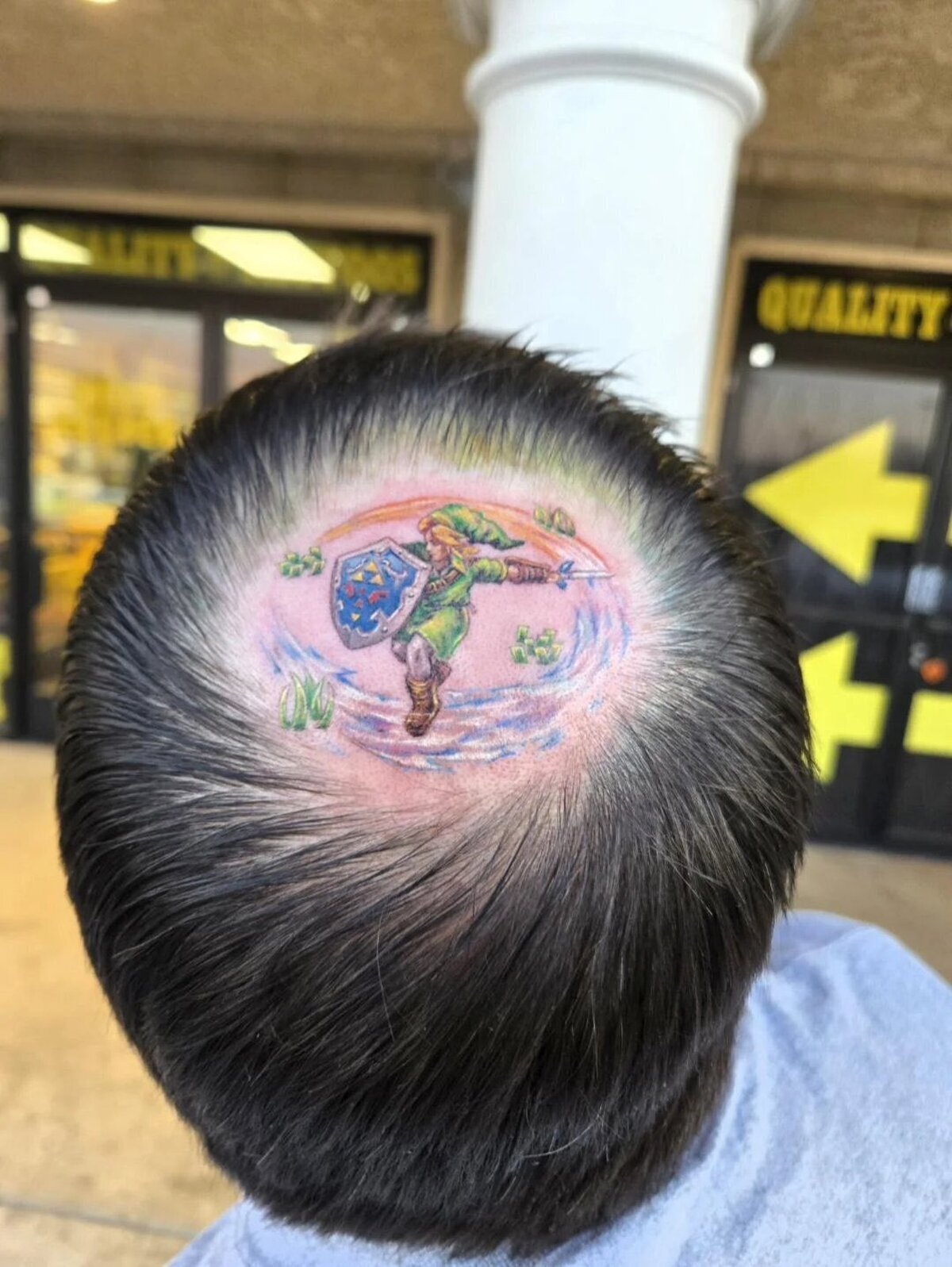 Aceptando la calvicie con gracia