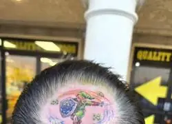 Aceptando la calvicie con gracia